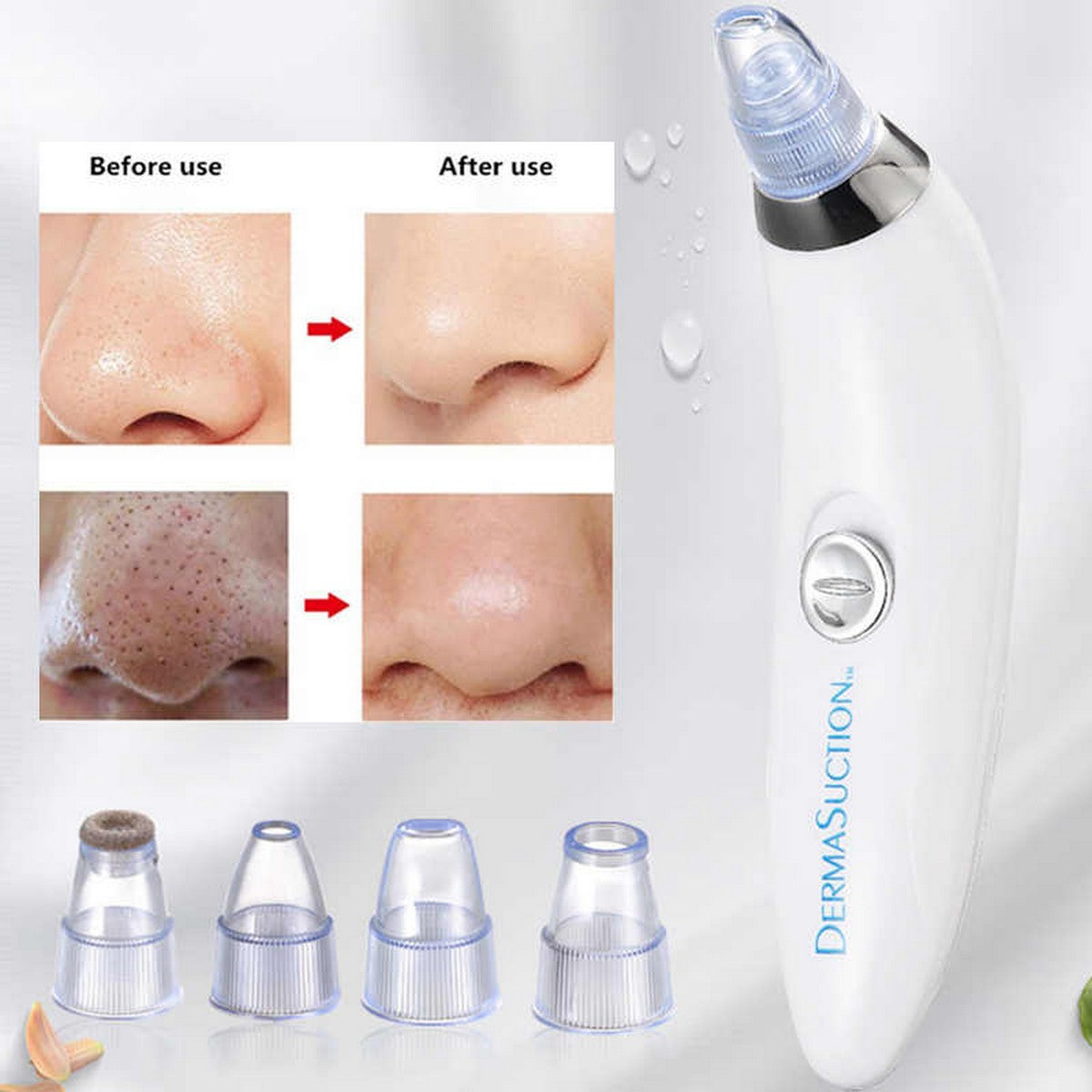 Derma Suction Blackhead Removal Machine